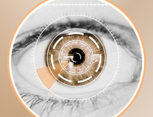 Vision Image